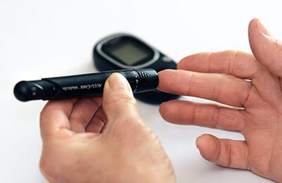激素治疗合并2型糖尿病不同血糖水平突发性聋患者的疗效分析